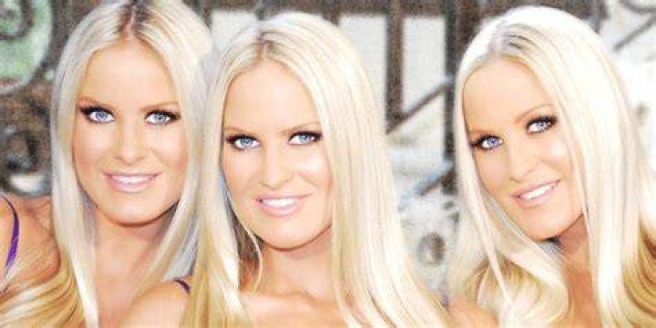 Dahm Triplets Wiki Bio, Parents, Plastic Surgery, Children, Net Worth