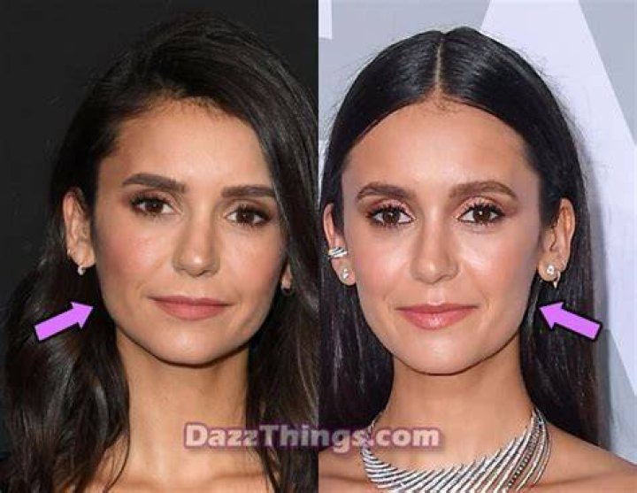
Did Nina Dobrev Get Plastic Surgery? Who is Nina Dobrev? Nina Dobrev’s Net Worth 