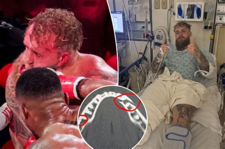 
Did Tom Browning Health And Injury Cause His Death? Broken Arm Update 