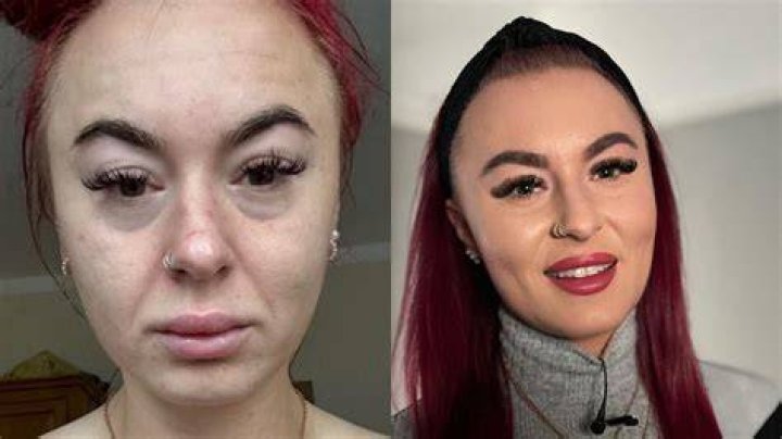 
Fans Think Sondra Theodore Teeth Appearance Is Due To Drugs Use But The Actress Says Otherwise 