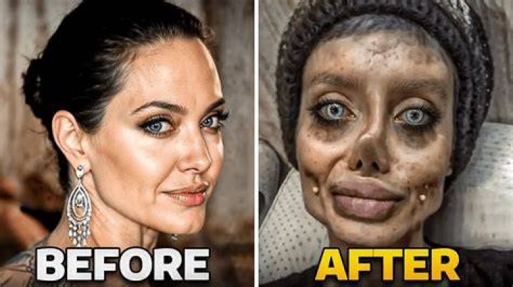 Has Kim Kun Hee Done Plastic Surgery?