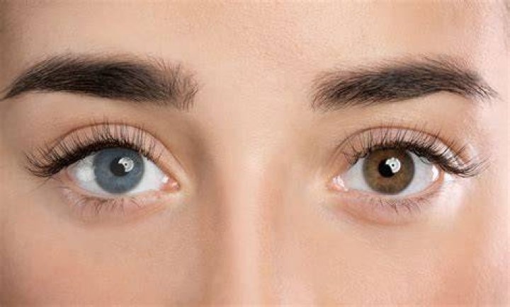 
Kate Bosworth Stated That She Used To Cover Up Her Heterochromia With Colored Contacts 