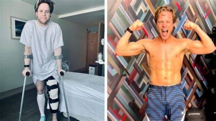 
Olly Murs Knee Surgery Update & Hospitalized Report On Twitter -Where Is He Now? 