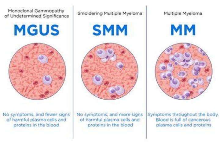 
Steve Scalise health: Multiple Myeloma treatment, symptoms, cause, hereditary and more 