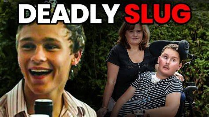 
Story: Sam Ballard Ate Slug Of Rat Lungworm On Dare – Rugby Player Death 
