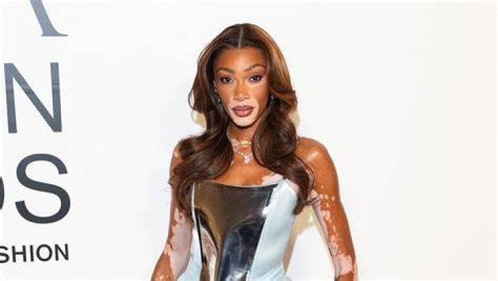 Winnie Harlow Height, Weight, Net Worth, Age, Birthday, Wikipedia, Who, Nationality, Biography
